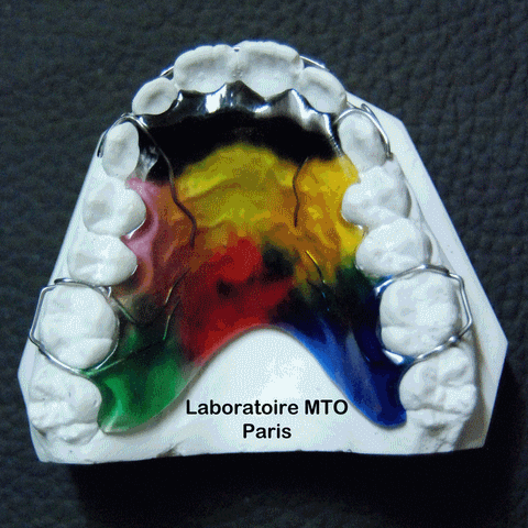 CONTENTION-ARC-DOUBLE-BOUCLE