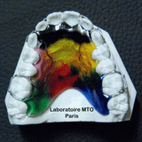 CONTENTION-ARC-DOUBLE-BOUCLE